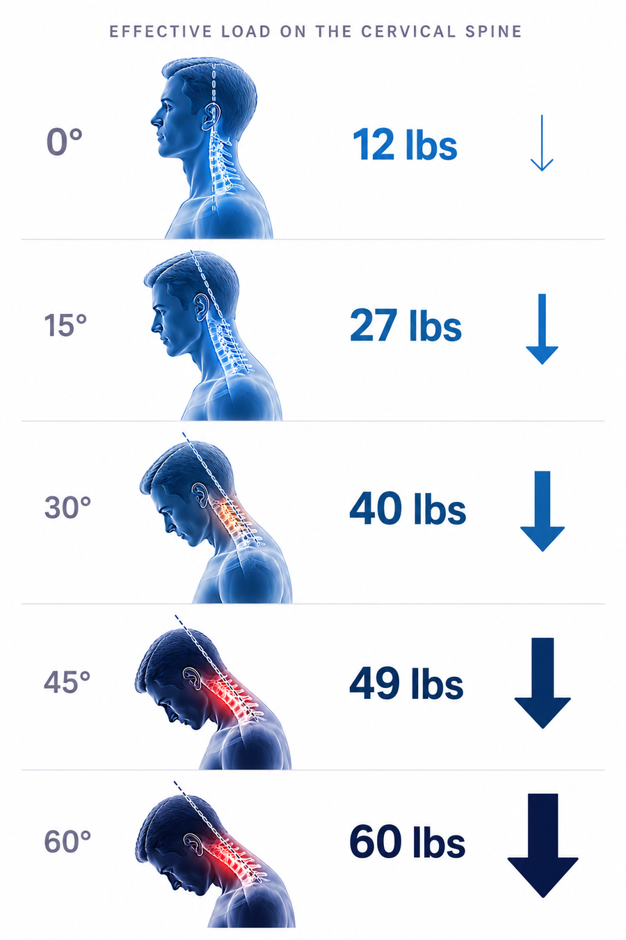 Forward head posture infographic — mobile